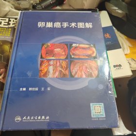 卵巢癌手术图解