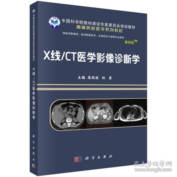 X线/CT医学影像诊断学