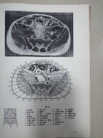 人体断面解剖学图谱