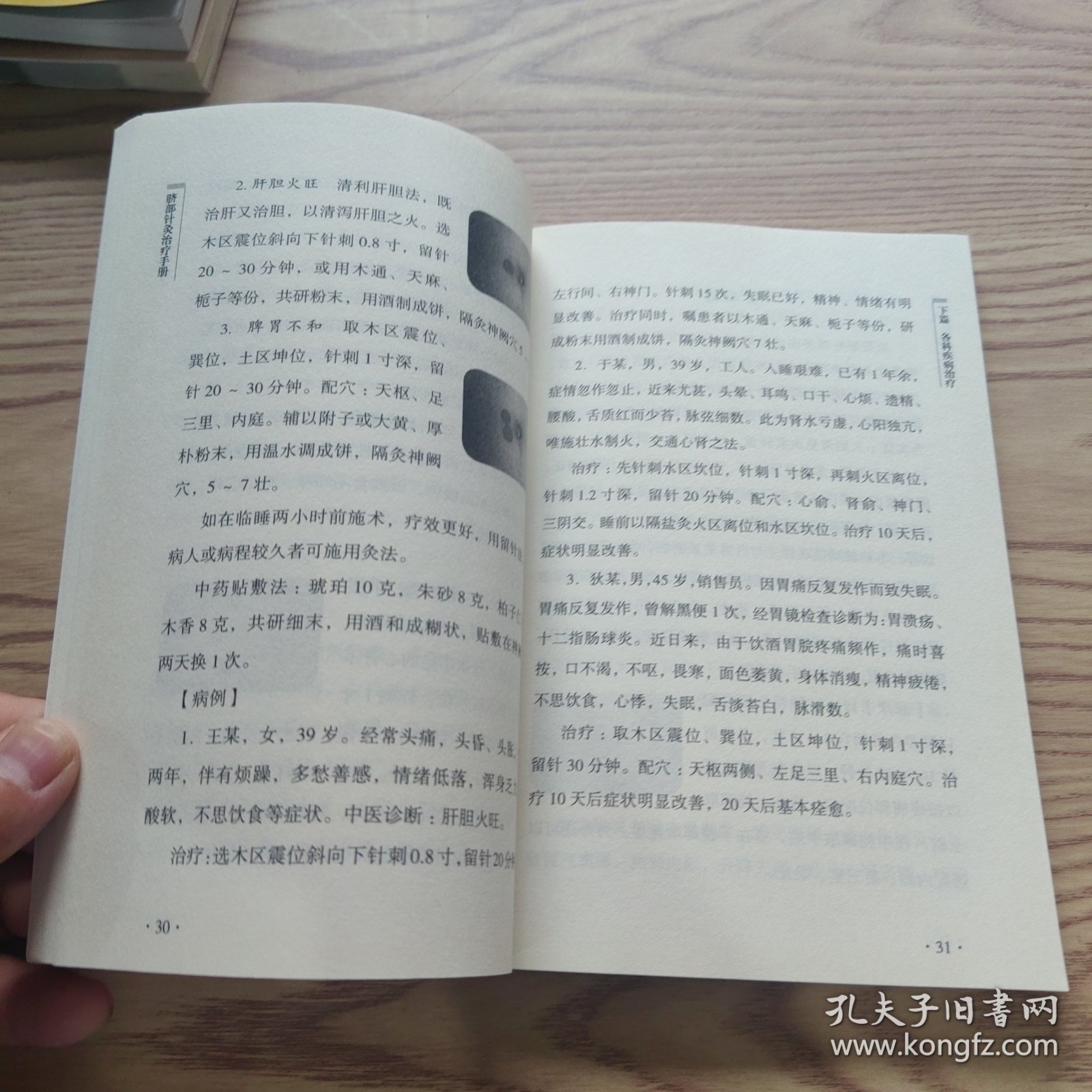 脐部针灸治疗手册