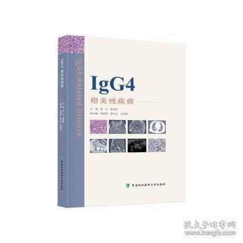 IgG4相关性疾病