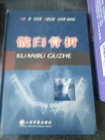 髋臼骨折