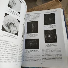 神经内科学高级教程