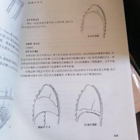 小儿外科手术图谱