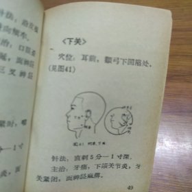 《简易针刺手册》