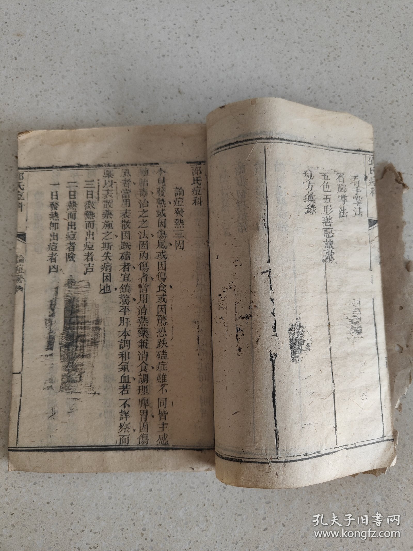 江西永丰 胡梅早春氏 刻本医学资料《邵氏痘科》单册内容共35页内容