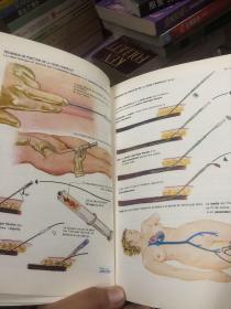 COLLECTION TARDIEU l'essentiel sur les pacemakers（原版英文）