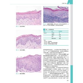 罗塞和阿克曼外科病理学 第11版(全2册)