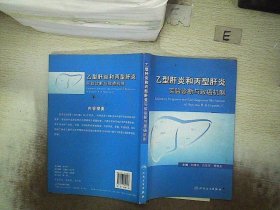 乙型肝炎和丙型肝炎實驗診斷與致癌機制