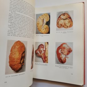 Atlas Der Pathologischen Anatomie : Eine Sammlung Typischer Krankheitsbilder Der Menschlichen Organe 病理解剖学