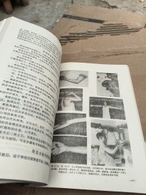 手外科学