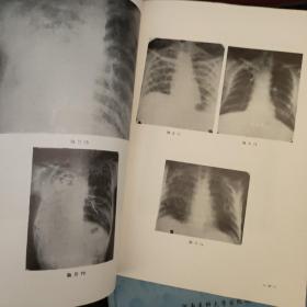 肺科临床读片