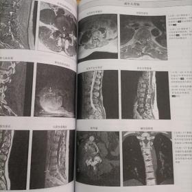 国际权威影像鉴别诊断丛书·影像专家鉴别诊断：颅脑与脊柱脊髓分册