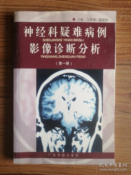 神经科疑难病例影像诊断分析  第一册