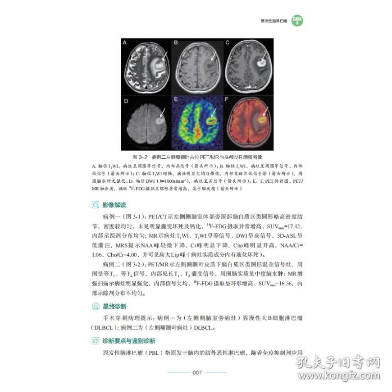 PET/CT与PET/MR疑难病例集萃