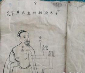 《凌氏针灸》：明代凌云针灸手抄本，里面共记载有 100 多个奇穴。很多内容都属全网首次呈现。