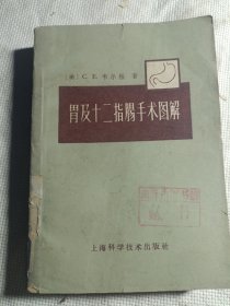 胃及十二指肠手术图解