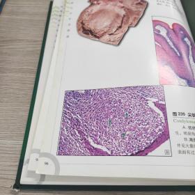 病理解剖学彩色图谱——医学教学图谱系列