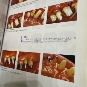 国际牙科系列名著走进中国：牙周外科学临床图谱