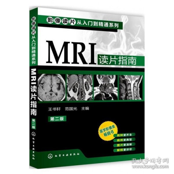 影像读片从入门到精通系列：MRI读片指南（第2版）