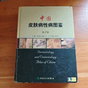 中国皮肤病性病图鉴（第2版）