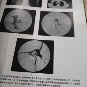 临床介入诊疗学