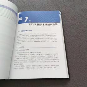 医学精萃系列--经导管主动脉瓣置换操作指南手册（签名本）