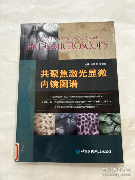 共聚焦激光显微内镜图谱