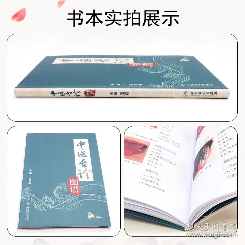 中医舌诊图谱