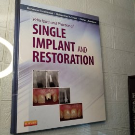 SINGLE IMPLANT AND RESTORATION 单个植入物和修复体