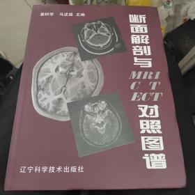 断面解剖与MRI CT ECT对照图谱