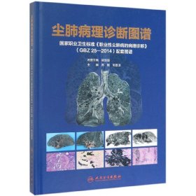 尘肺病理诊断图谱·国家职业卫生标准《职业性尘肺病的病理诊断》(GBZ25-2014)配套图谱