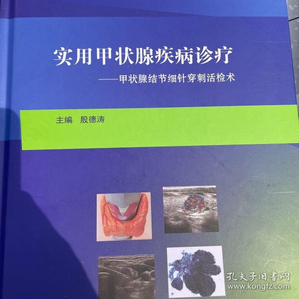 实用甲状腺疾病诊疗--甲状腺结节细针穿刺活检术(精)正版硬精装