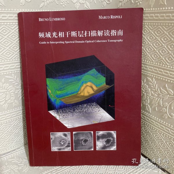 频域光相干断层扫描解读指南（献给资深眼科医生） 16开铜版彩印