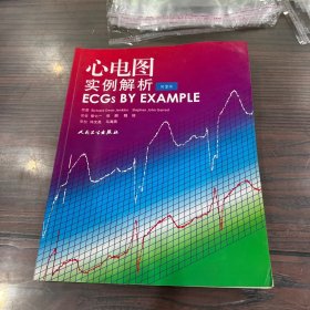心电图实例解析