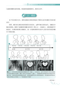 发育性髋关节发育不良——从早期超声诊断到有效治疗