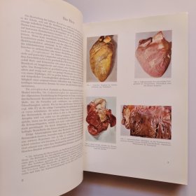 Atlas Der Pathologischen Anatomie : Eine Sammlung Typischer Krankheitsbilder Der Menschlichen Organe 病理解剖学