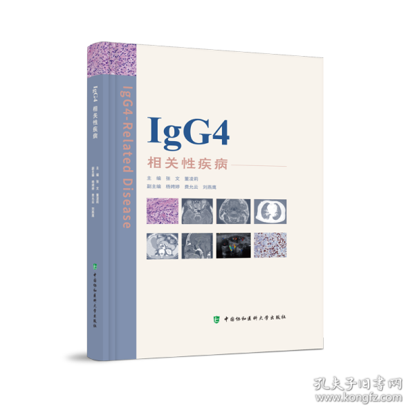 IgG4相关性疾病