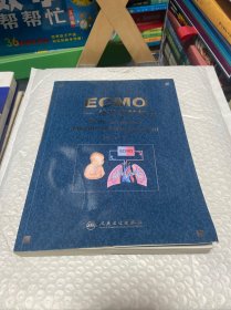 ECMO：体外膜肺氧合