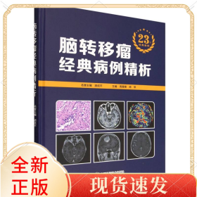 脑转移瘤经典病例精析