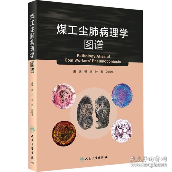 煤工尘肺病理学图谱