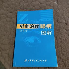 针刺治疗眼病图解