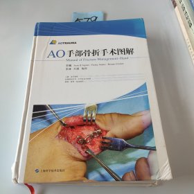 AO手部骨折手术图解