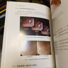 放大胃镜观察技巧（附光盘）