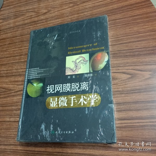 视网膜脱离显微手术学