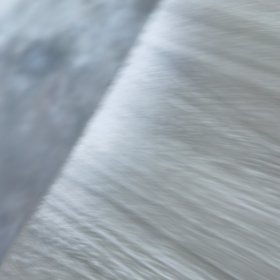 小儿心肌病。看图片有点伤