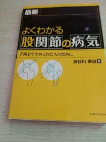 よくわかる
股関节の病気