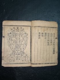 清中医《针灸便览》一册全。内包含祝由十三科。古籍是古人思想的宝藏、先贤智慧的结晶，古籍关注度的提升，对历史有重要了解的意义。品如图，前后完整不缺页，具体如图。