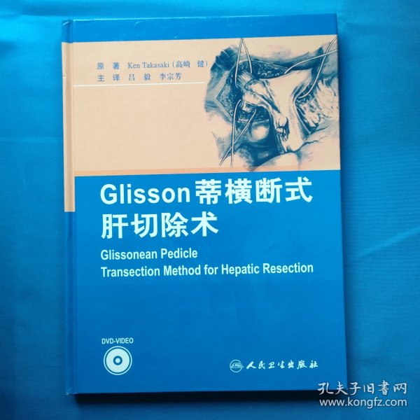 Glisson蒂横断式肝切除术