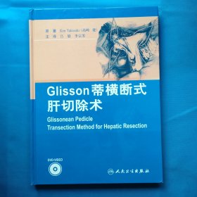 Glisson蒂横断式肝切除术